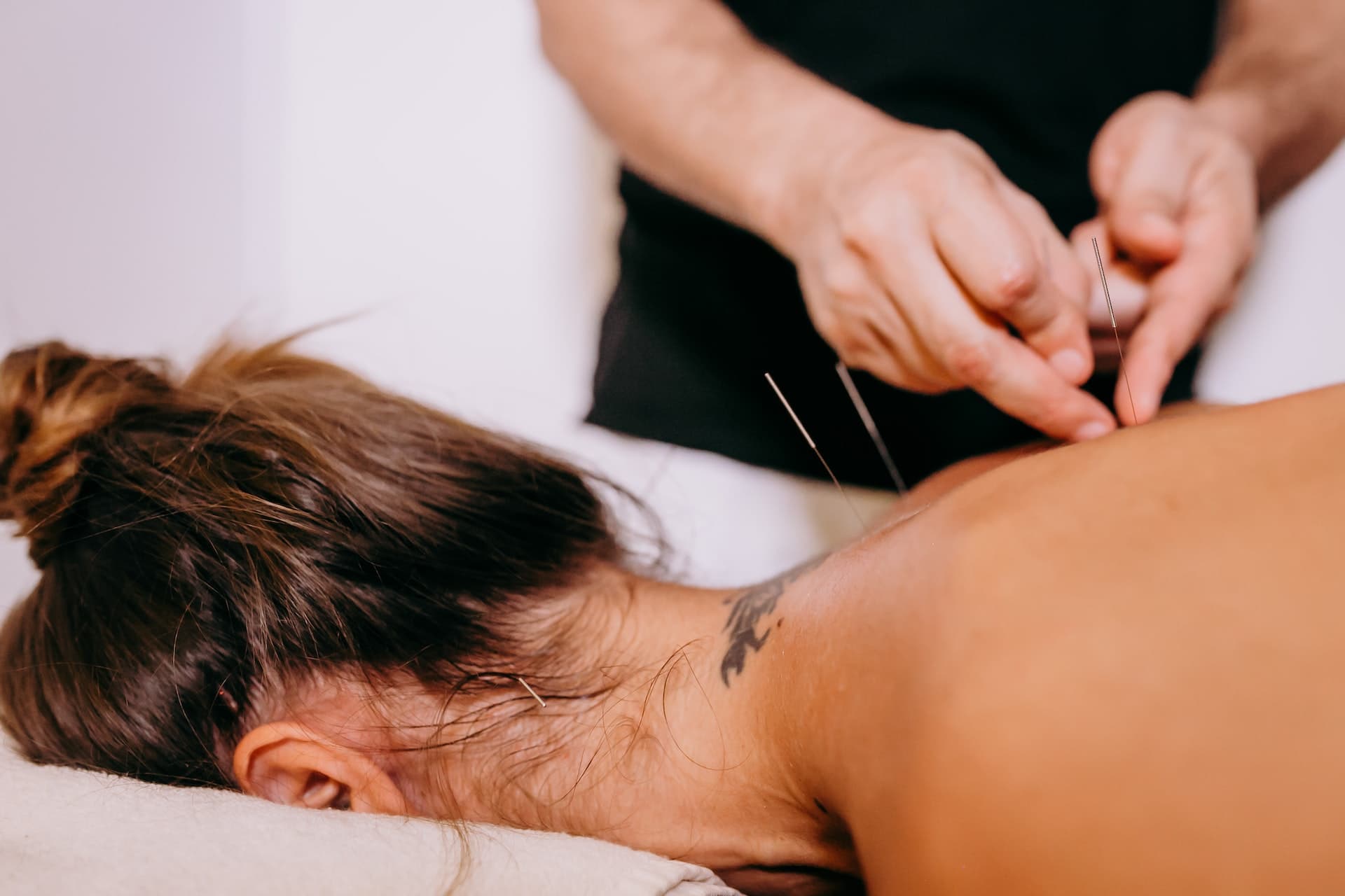 A woman who gets acupuncture treatment.